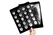 radiologia-opere-equipamentos-para-diagnostico